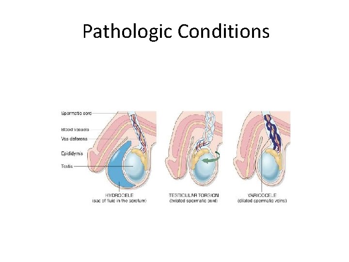 Pathologic Conditions 