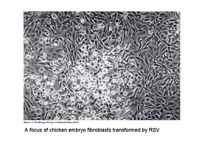 A focus of chicken embryo fibroblasts transformed by RSV 