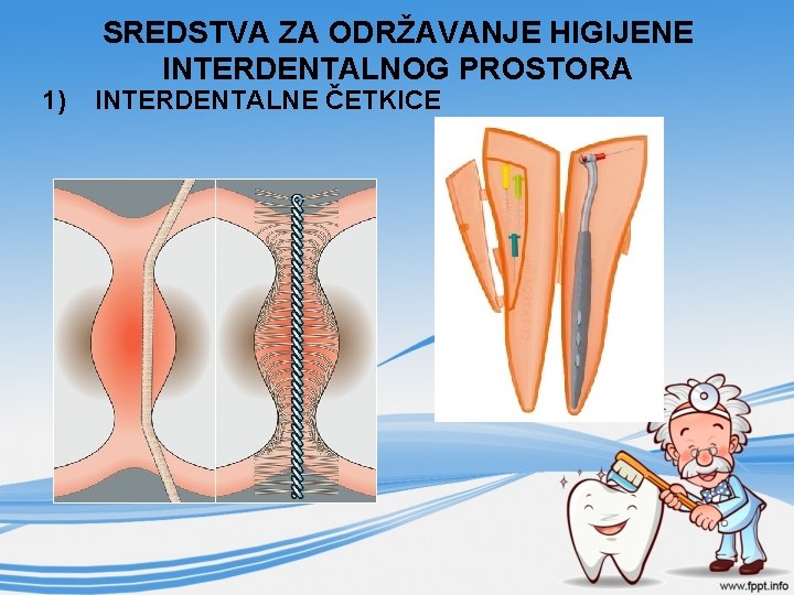 1) SREDSTVA ZA ODRŽAVANJE HIGIJENE INTERDENTALNOG PROSTORA INTERDENTALNE ČETKICE 