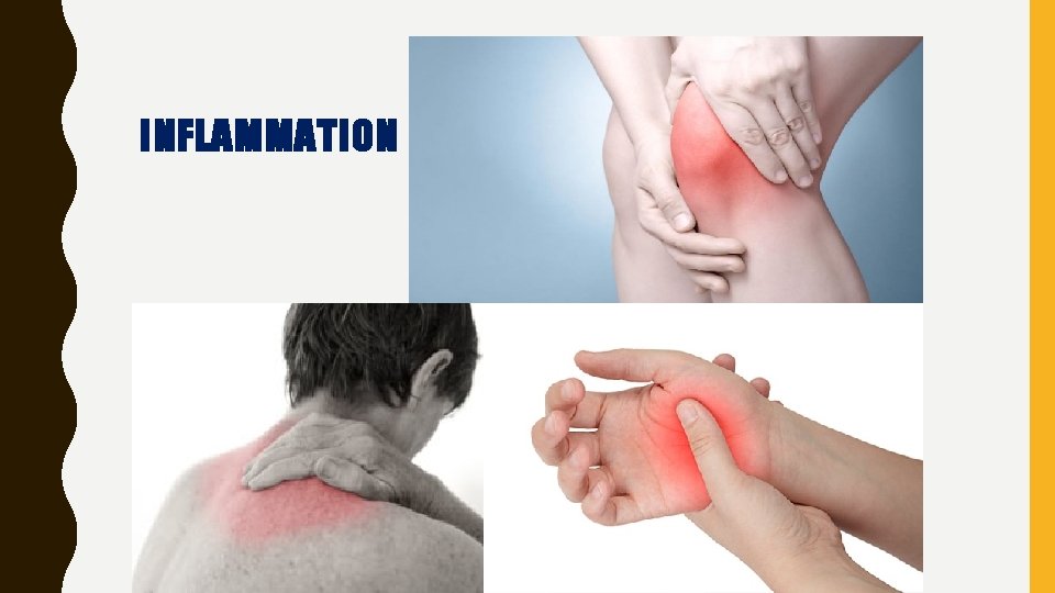 INFLAMMATION 