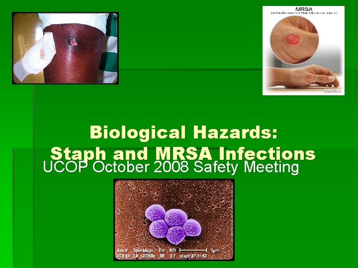 Biological Hazards: Staph and MRSA Infections UCOP October 2008 Safety Meeting 
