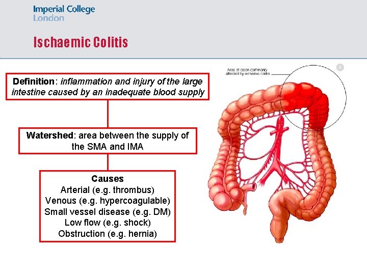 Ischaemic Colitis Definition: inflammation and injury of the large intestine caused by an inadequate