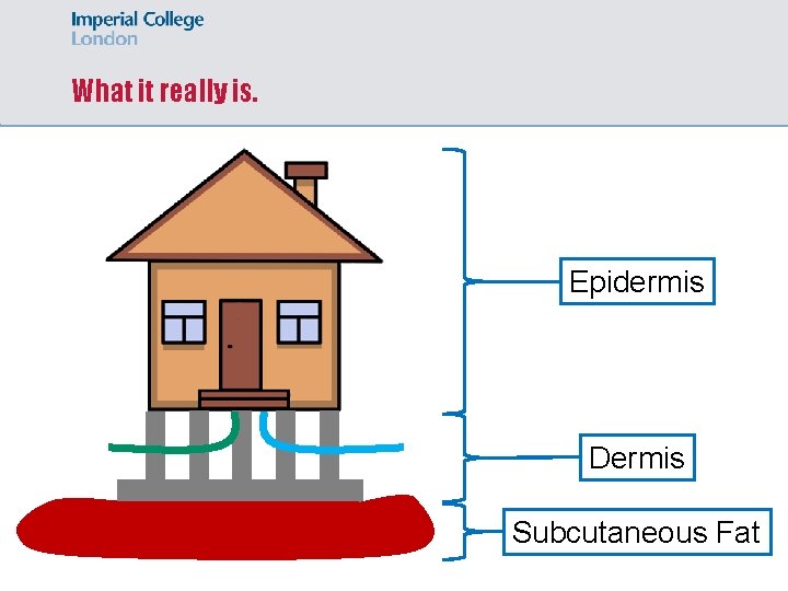 What it really is. Epidermis Dermis Subcutaneous Fat 