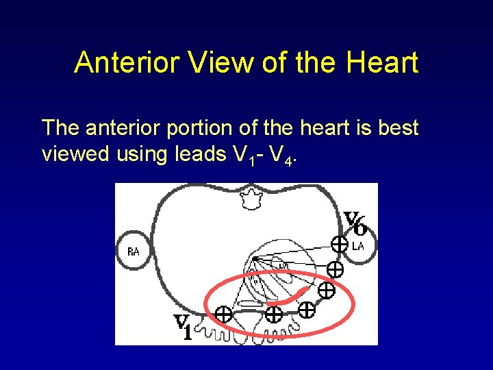 Anterior View of the Heart The anterior portion of the heart is best viewed