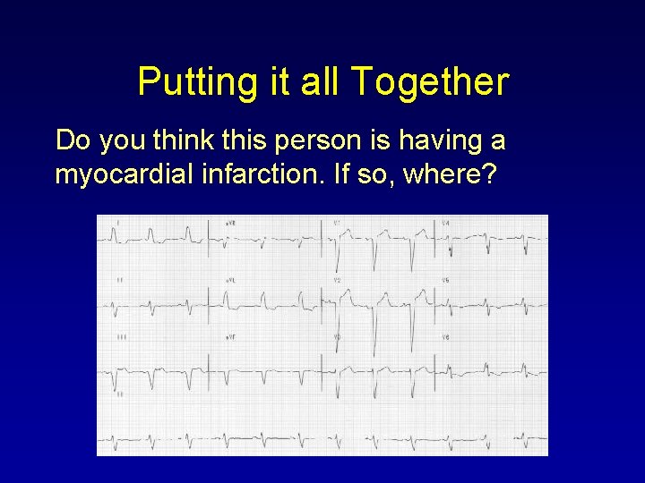 Putting it all Together Do you think this person is having a myocardial infarction.