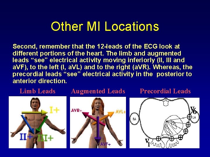Other MI Locations Second, remember that the 12 -leads of the ECG look at