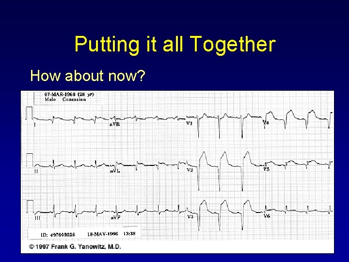 Putting it all Together How about now? 