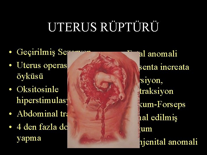 UTERUS RÜPTÜRÜ • Geçirilmiş Sezaryen • Uterus operasyonu öyküsü • Oksitosinle hiperstimulasyon • Abdominal