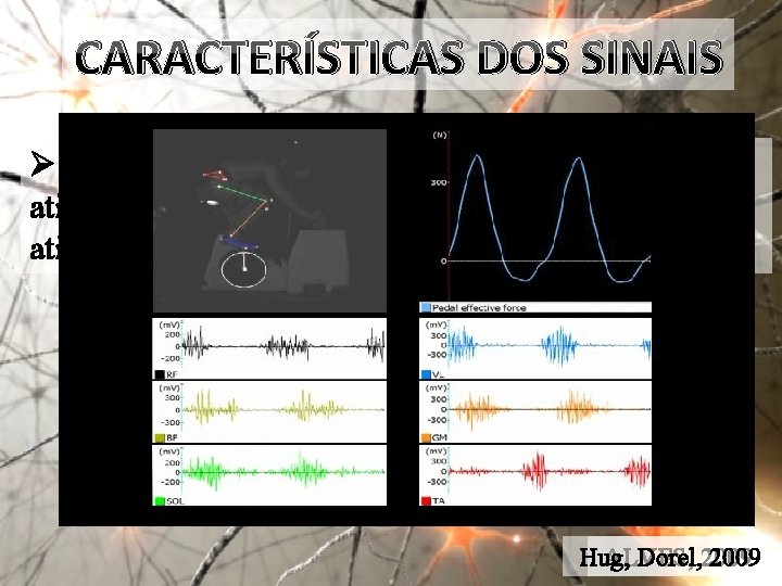 CARACTERÍSTICAS DOS SINAIS Ø Análise qualitativa: Primeira avaliação da atividade muscular e identificação do