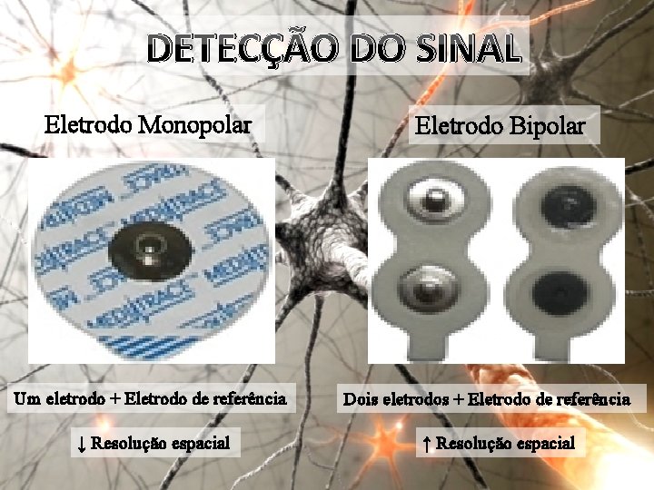 DETECÇÃO DO SINAL Eletrodo Monopolar Um eletrodo + Eletrodo de referência ↓ Resolução espacial