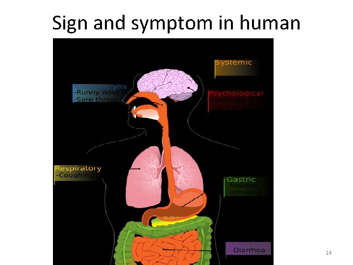 Sign and symptom in human 14 Sign and symptom in human 14