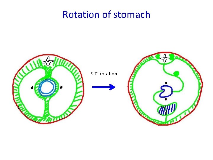 Rotation of stomach 90 rotation 