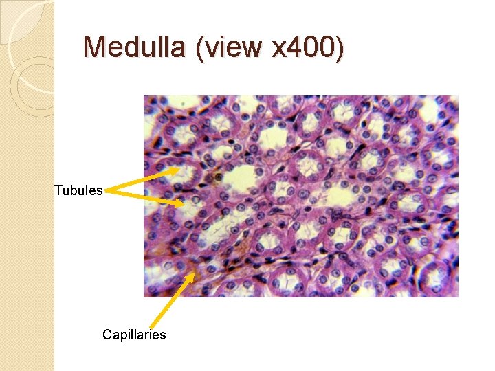 Medulla (view x 400) Tubules Capillaries 