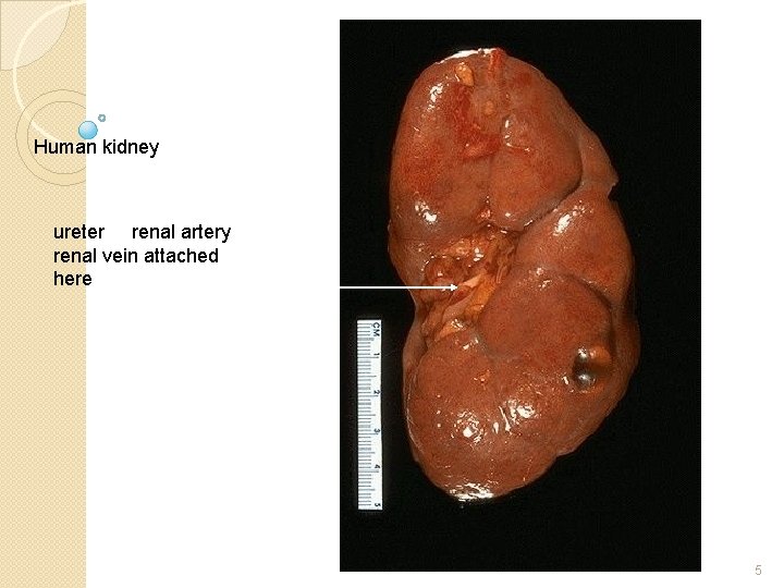Human kidney ureter renal artery renal vein attached here 5 