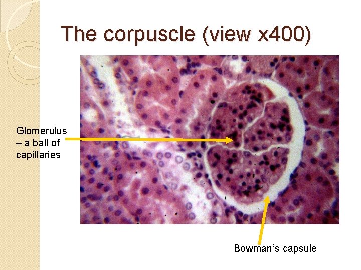 The corpuscle (view x 400) Glomerulus – a ball of capillaries Bowman’s capsule 