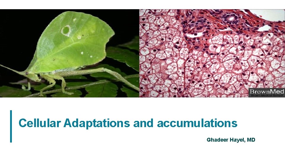 Cellular Adaptations and accumulations Ghadeer Hayel, MD 1 