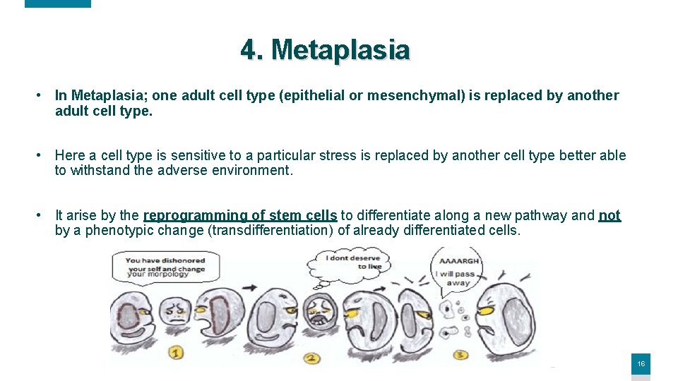 4. Metaplasia • In Metaplasia; one adult cell type (epithelial or mesenchymal) is replaced