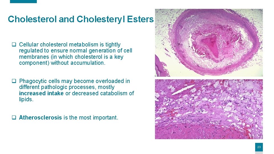 Cholesterol and Cholesteryl Esters q Cellular cholesterol metabolism is tightly regulated to ensure normal Cholesterol and Cholesteryl Esters q Cellular cholesterol metabolism is tightly regulated to ensure normal