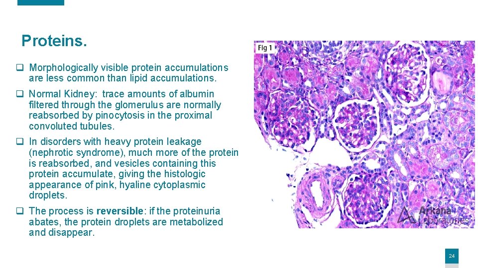 Proteins. q Morphologically visible protein accumulations are less common than lipid accumulations. q Normal