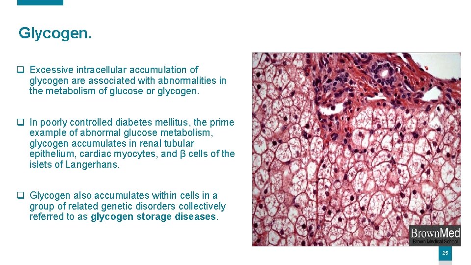 Glycogen. q Excessive intracellular accumulation of glycogen are associated with abnormalities in the metabolism