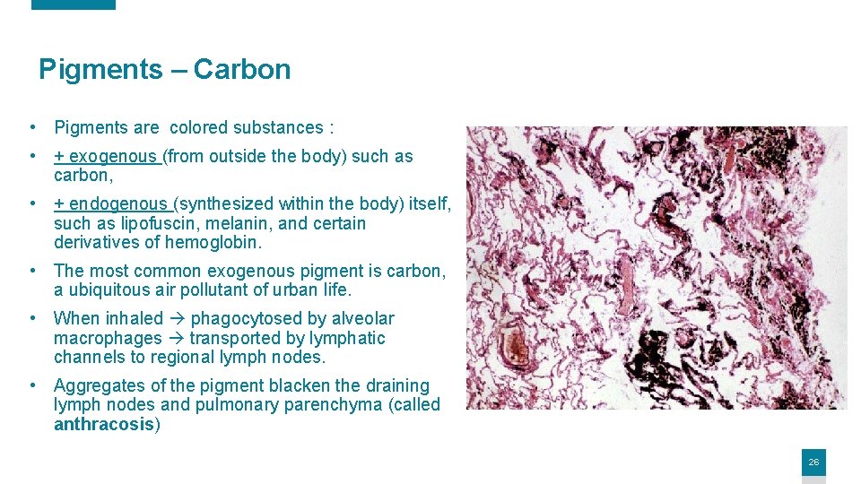 Pigments – Carbon • Pigments are colored substances : • + exogenous (from outside