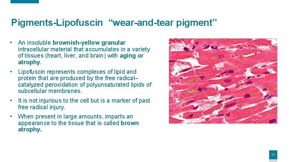 Pigments-Lipofuscin “wear-and-tear pigment’’ • An insoluble brownish-yellow granular intracellular material that accumulates in a