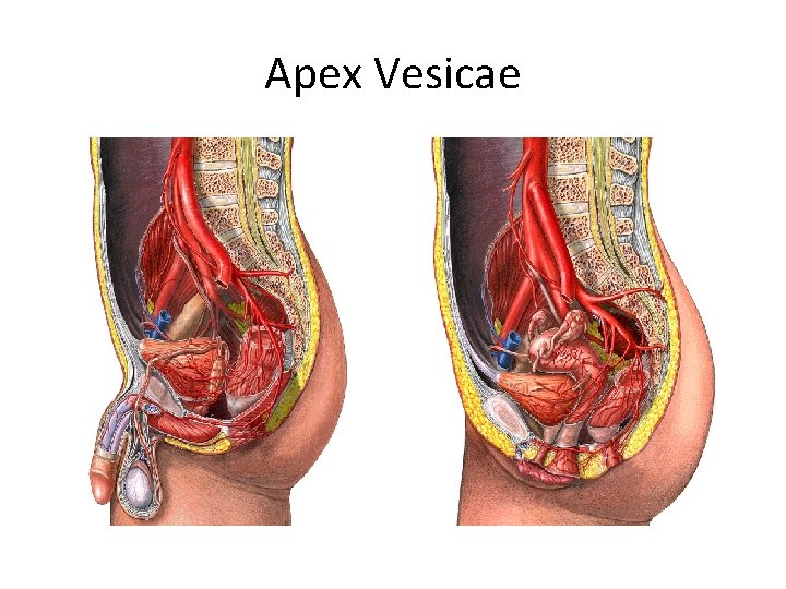 Apex Vesicae 