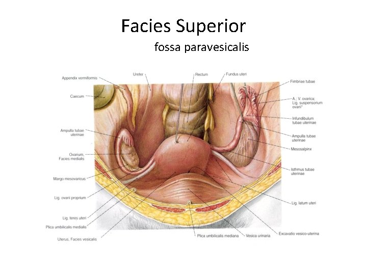 Facies Superior fossa paravesicalis 