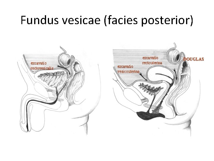 Fundus vesicae (facies posterior) excavatio rectovesicalis excavatio vesicouterina excavatio rectouterina DOUGLAS 