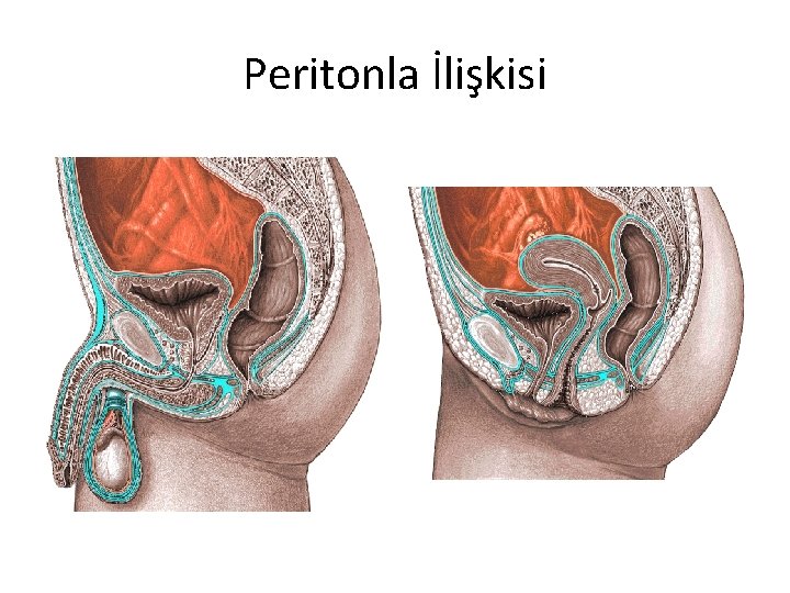 Peritonla İlişkisi 