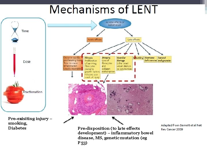 Pre-exisiting injury – smoking, Diabetes Pre-disposition (to late effects development) – inflammatory bowel disease,