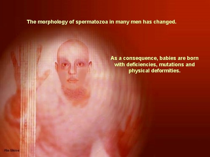 The morphology of spermatozoa in many men has changed. As a consequence, babies are
