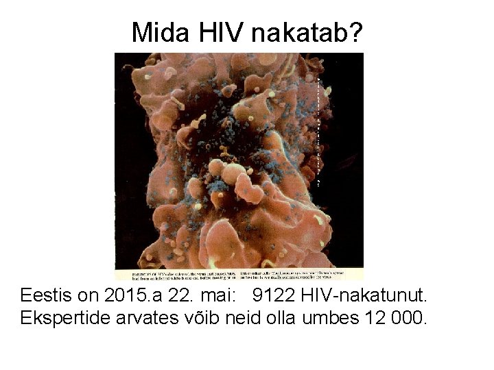 Mida HIV nakatab? Eestis on 2015. a 22. mai: 9122 HIV-nakatunut. Ekspertide arvates võib