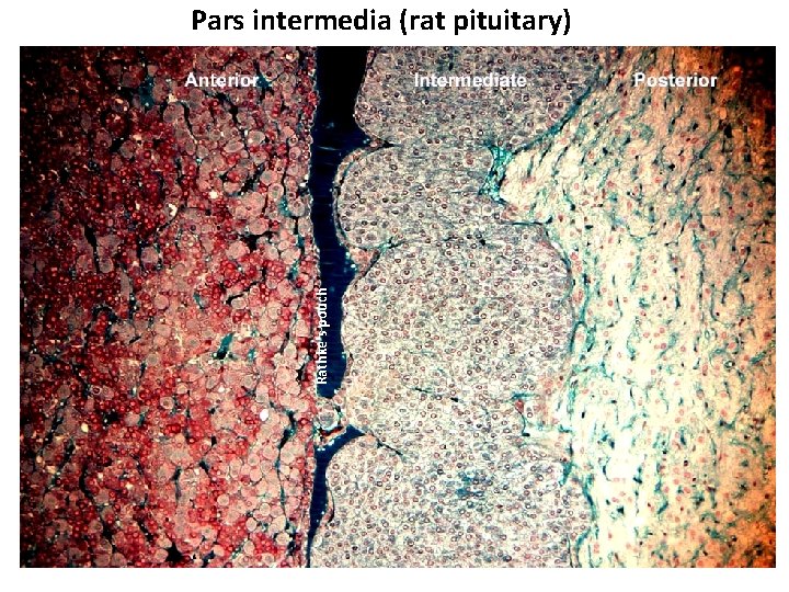 Rathke's pouch Pars intermedia (rat pituitary) 