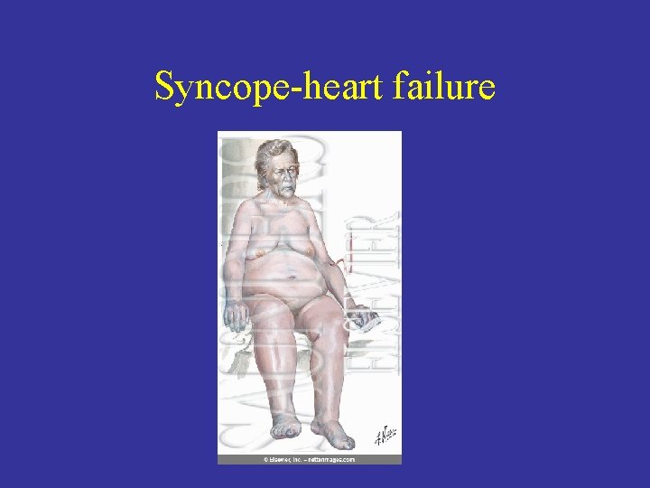 Syncope-heart failure 