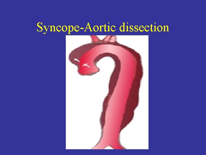 Syncope-Aortic dissection 
