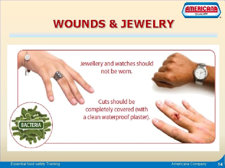 WOUNDS & JEWELRY Essential food safety Training Americana Company 14 