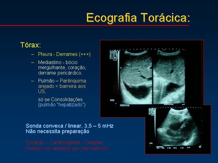 Ecografia Torácica: Tórax: – Pleura - Derrames (+++) – Mediastino - bócio mergulhante, coração,