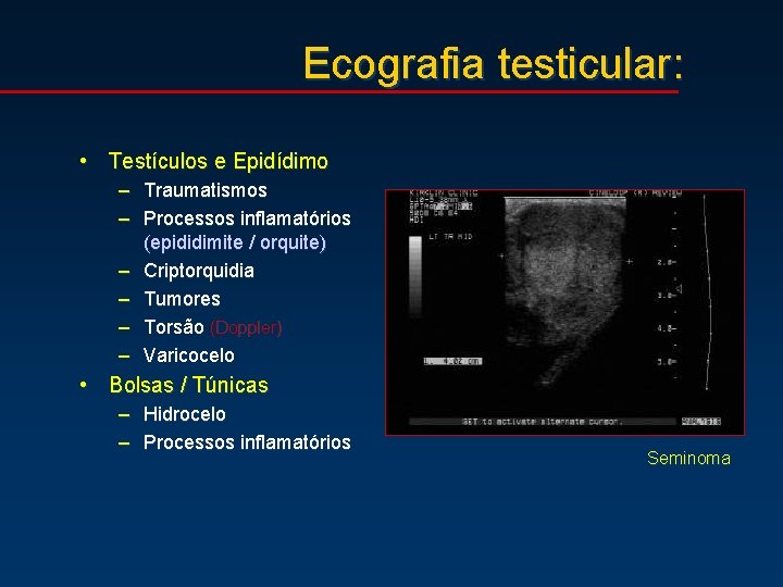 Ecografia testicular: • Testículos e Epidídimo – Traumatismos – Processos inflamatórios (epididimite / orquite)