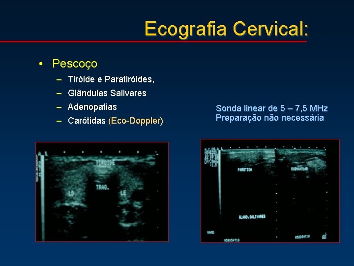 Ecografia Cervical: • Pescoço – Tiróide e Paratiróides, – Glândulas Salivares – Adenopatias –