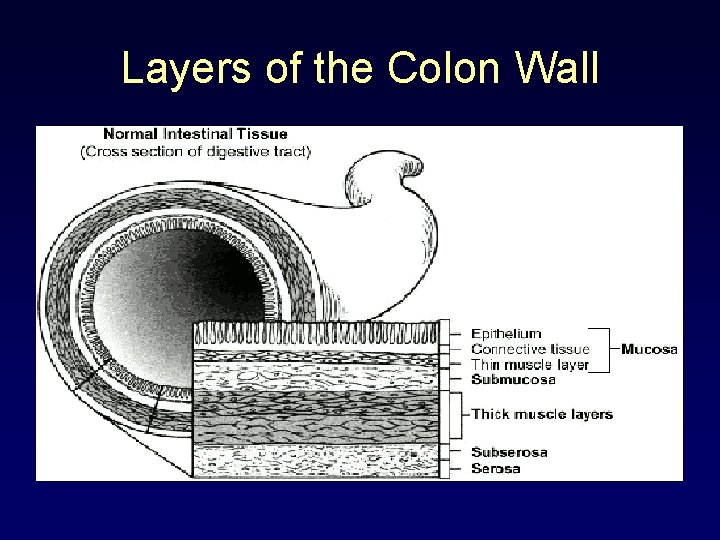 Layers of the Colon Wall 