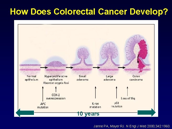 How Does Colorectal Cancer Develop? 10 years Janne PA, Mayer RJ. N Engl J