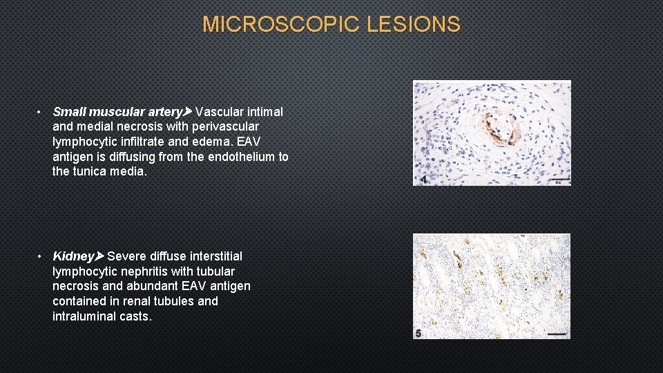 MICROSCOPIC LESIONS • Small muscular artery Vascular intimal and medial necrosis with perivascular lymphocytic