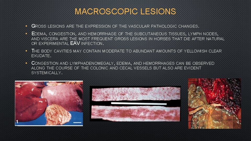 MACROSCOPIC LESIONS • GROSS LESIONS ARE THE EXPRESSION OF THE VASCULAR PATHOLOGIC CHANGES. •