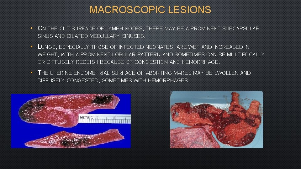 MACROSCOPIC LESIONS • ON THE CUT SURFACE OF LYMPH NODES, THERE MAY BE A