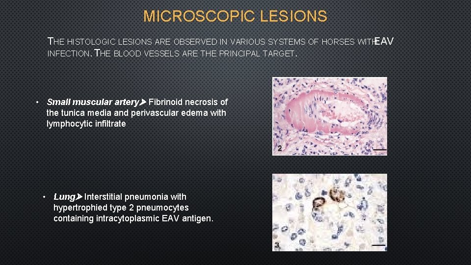 MICROSCOPIC LESIONS THE HISTOLOGIC LESIONS ARE OBSERVED IN VARIOUS SYSTEMS OF HORSES WITHEAV INFECTION.