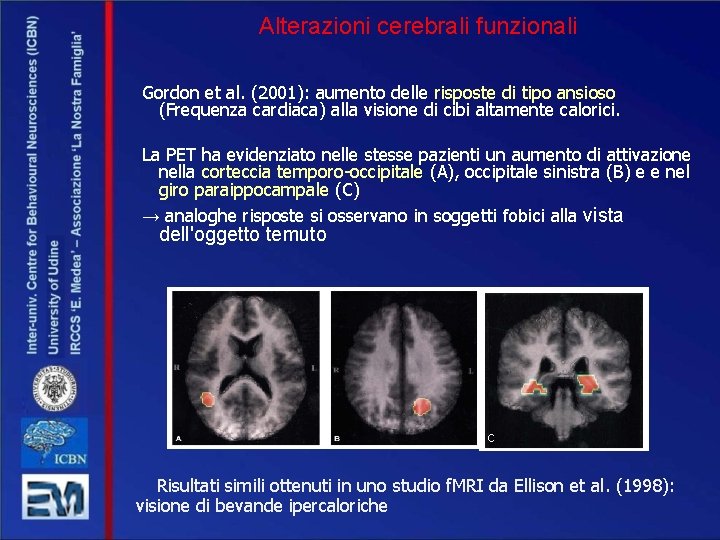 Alterazioni cerebrali funzionali Gordon et al. (2001): aumento delle risposte di tipo ansioso (Frequenza