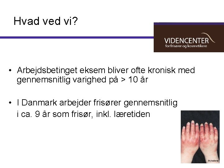 Hvad ved vi? • Arbejdsbetinget eksem bliver ofte kronisk med gennemsnitlig varighed på >