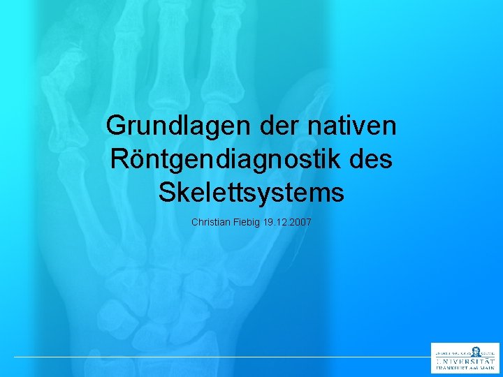 Grundlagen der nativen Röntgendiagnostik des Skelettsystems Christian Fiebig 19. 12. 2007 