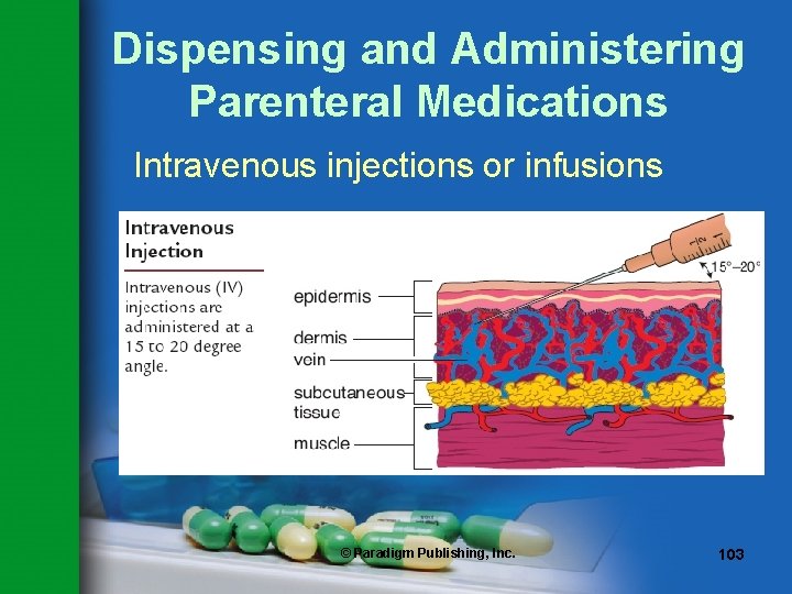 Dispensing and Administering Parenteral Medications Intravenous injections or infusions © Paradigm Publishing, Inc. 103